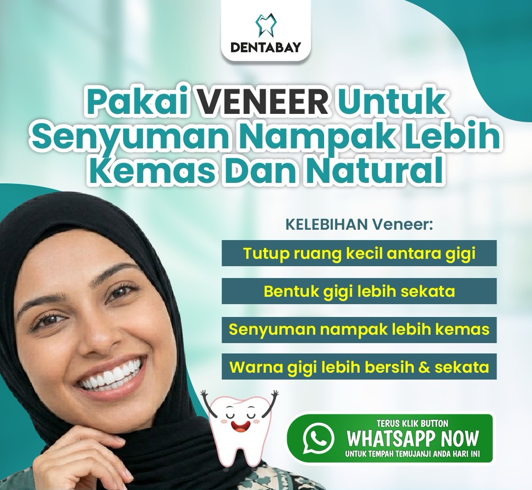 Veneer