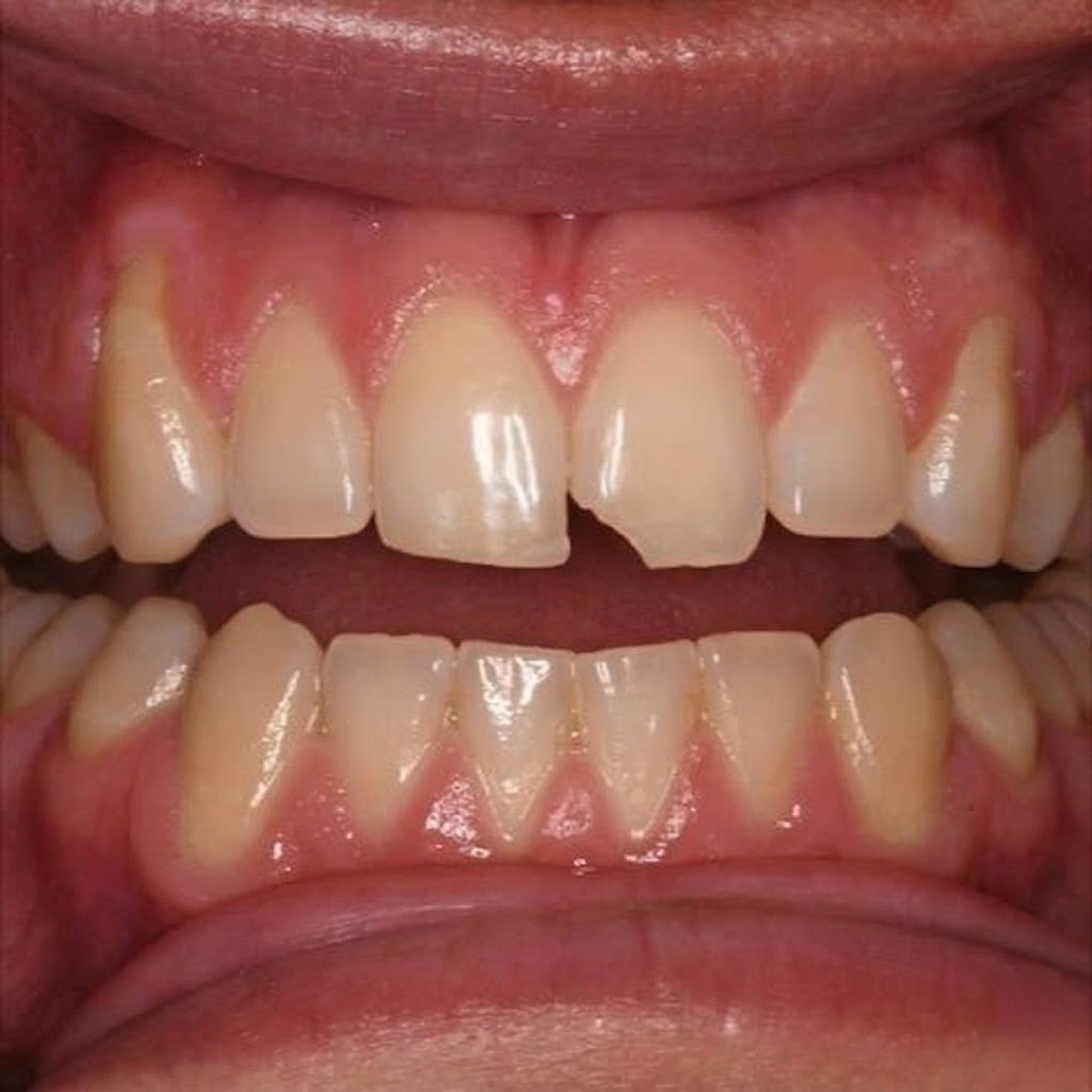 Dental treatment example