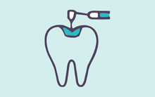 Dental restoration treatment